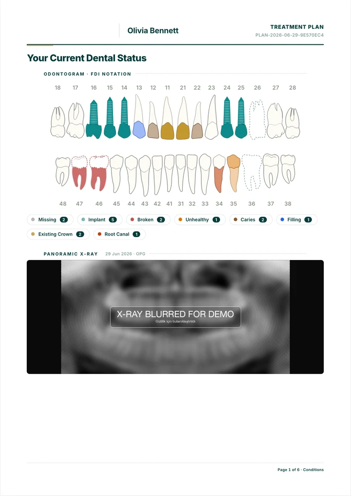 Dental tedavi planı PDF örneği: diş şeması ve panoramik röntgen